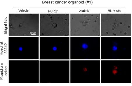 Growth-promoting function of the cGAS-STING pathway in triple-negative breast cancer cells